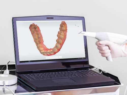 Trios® Scanner