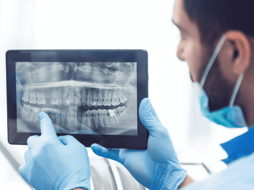 Digital X-Rays