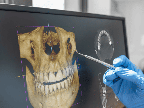 3-D Dental Imaging